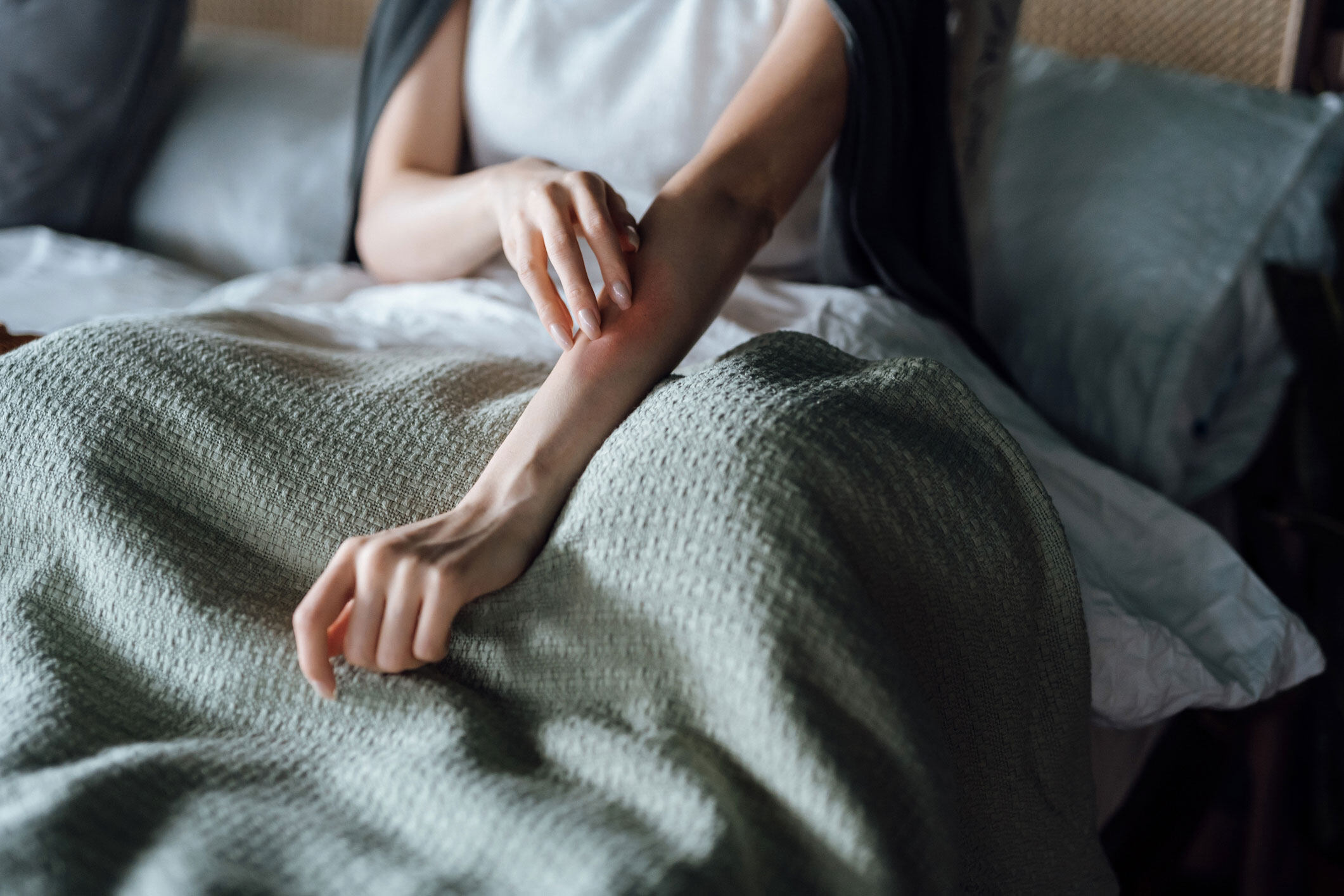 皮膚過敏5大種類｜一文了解濕疹、蕁麻疹、紅疹的症狀 醫生教你急救護理方法