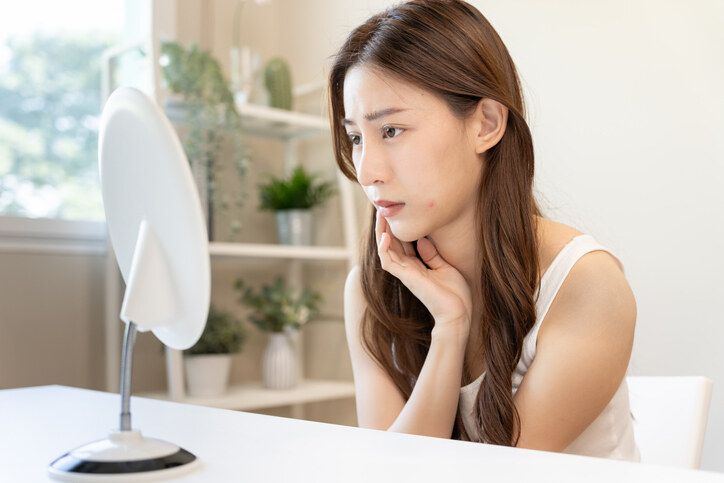 石頭瘡急救方法|8大治療方法針對閉口痘症狀|網民大推降紅消腫恩物 石頭瘡急救方法|8大治療方法針對閉口痘症狀|網民大推降紅消腫恩物