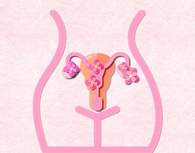 子宮肌瘤｜醫生公開4大徵兆及治療方法：血量多、經痛都要注意！