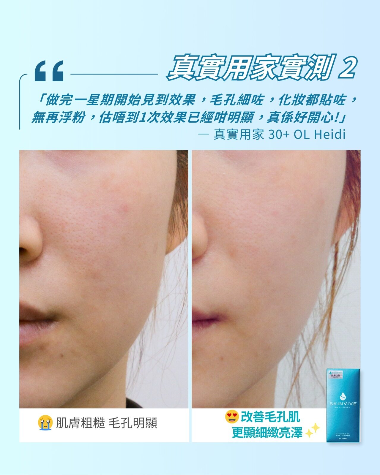 乾燥、毛孔粗大、膚色暗沉者必看!️昇光燈泡肌原來靠「它」養成~ COLLAGEN +首批引入,一步素顏細緻到爆光! 乾燥、毛孔粗大、膚色暗沉者必看!️昇光燈泡肌原來靠「它」養成~ COLLAGEN +首批引入,一步素顏細緻到爆光!