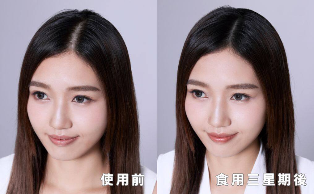 改善脫髮白髮不應該只得50分|正確激活生髮:全靠維特健靈「維新烏絲素」內調養肝補腎 改善脫髮白髮不應該只得50分|正確激活生髮:全靠維特健靈「維新烏絲素」內調養肝補腎