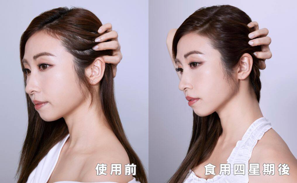 改善脫髮白髮不應該只得50分|正確激活生髮:全靠維特健靈「維新烏絲素」內調養肝補腎 改善脫髮白髮不應該只得50分|正確激活生髮:全靠維特健靈「維新烏絲素」內調養肝補腎