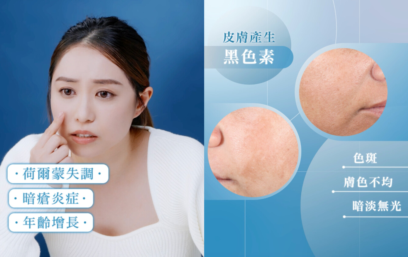 自帶亮肌Filter的護膚秘訣|SkinCeuticals全新發光瓶✨兩週擊退色斑痘印、提亮均匀膚色 自帶亮肌Filter的護膚秘訣|SkinCeuticals全新發光瓶✨兩週擊退色斑痘印、提亮均匀膚色
