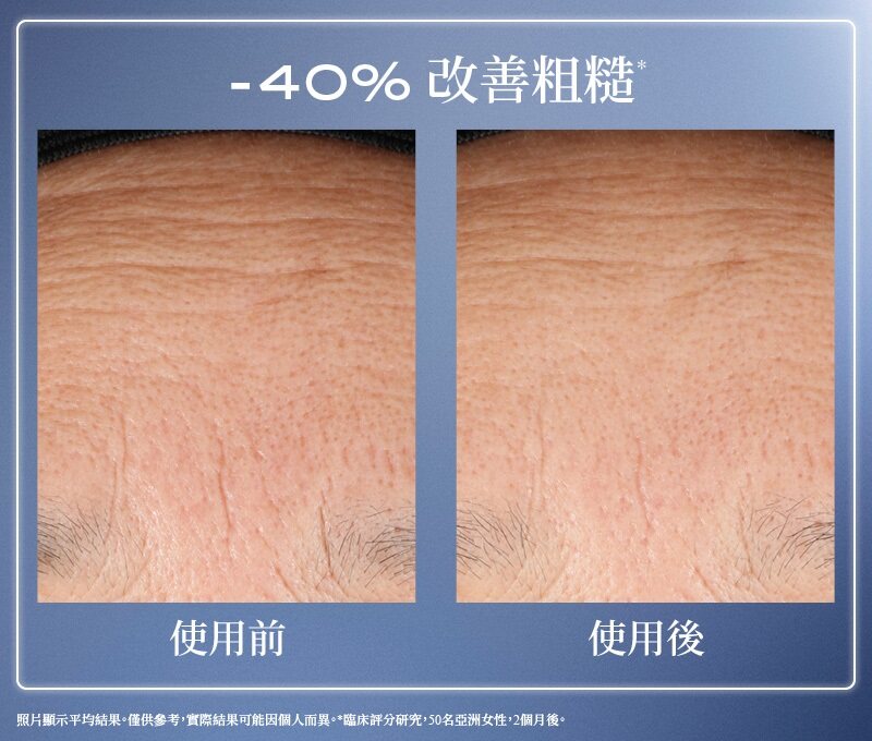 逆齡修復黑科技！Lancôme 全新「逆時小黑瓶」 Génifique 煥活修護精華登場、7天極速修護1年肌膚損害