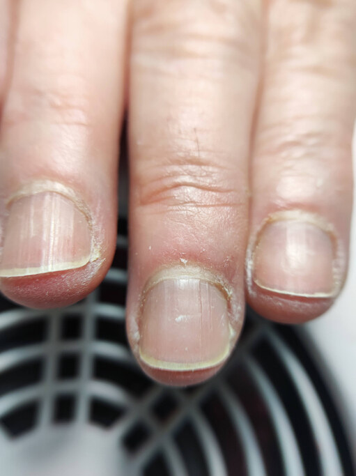 Soft gel vs Hard gel分別在哪？兩者優點缺點比較｜附gel甲後護理方法