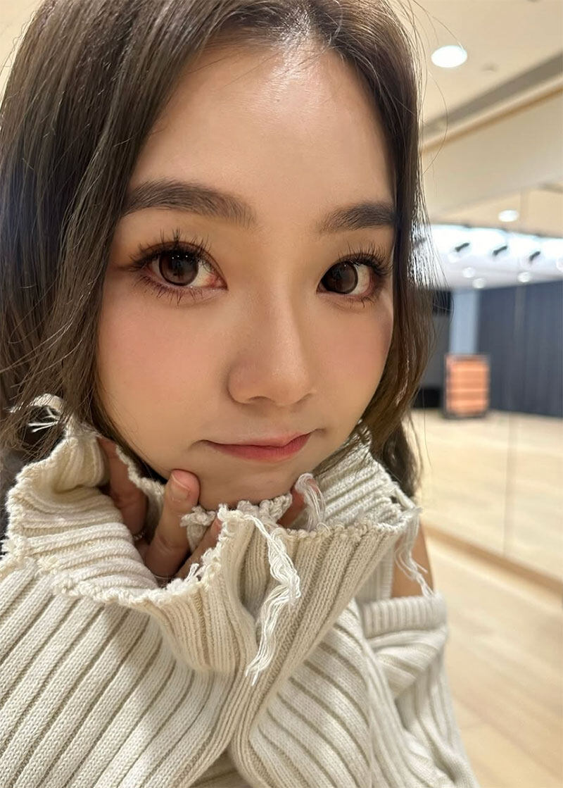 20+歲眼部肌膚主要問題是浮腫 20+歲眼部肌膚主要問題是浮腫