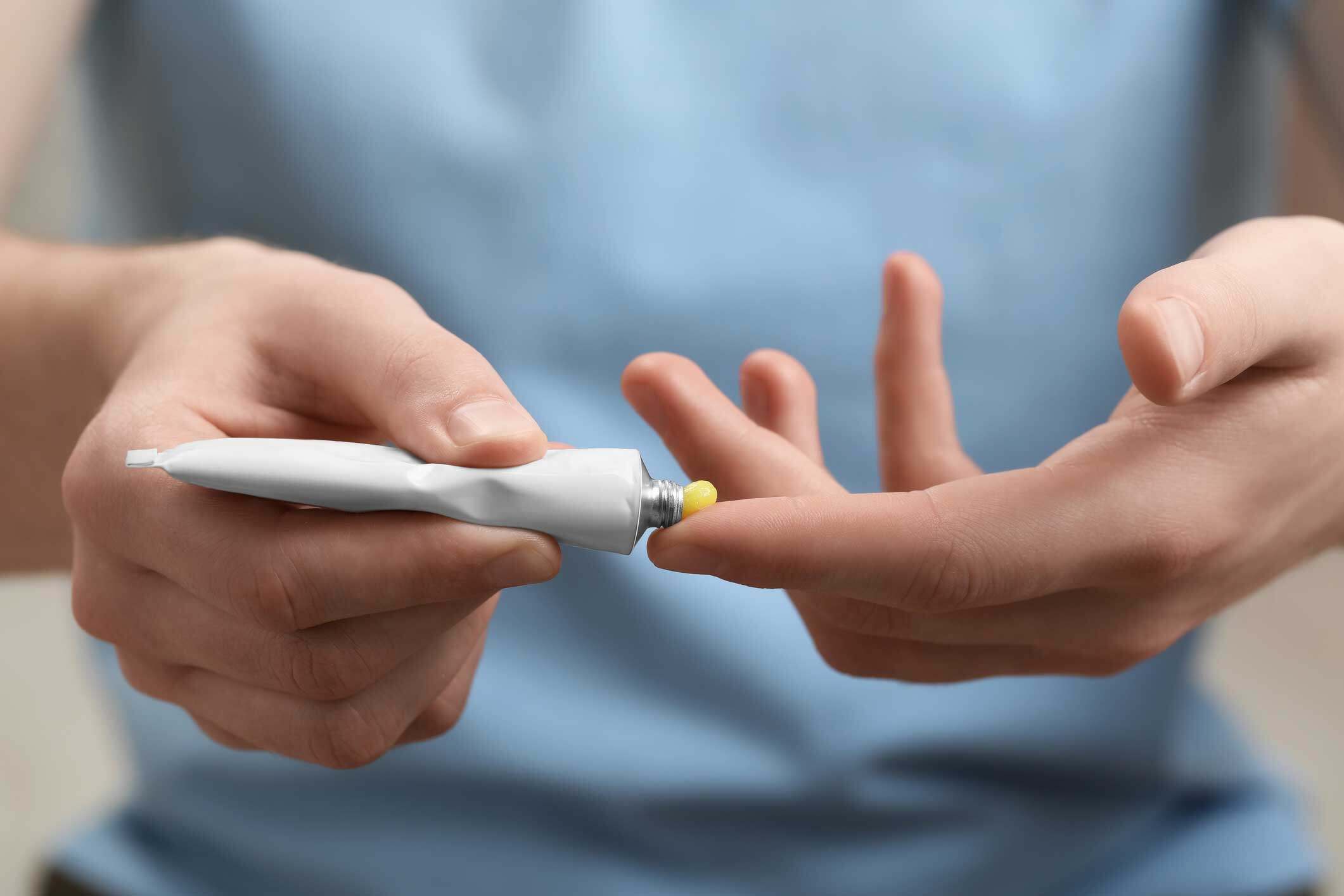 皮膚過敏5大種類｜一文了解濕疹、蕁麻疹、紅疹的症狀 醫生教你急救護理方法