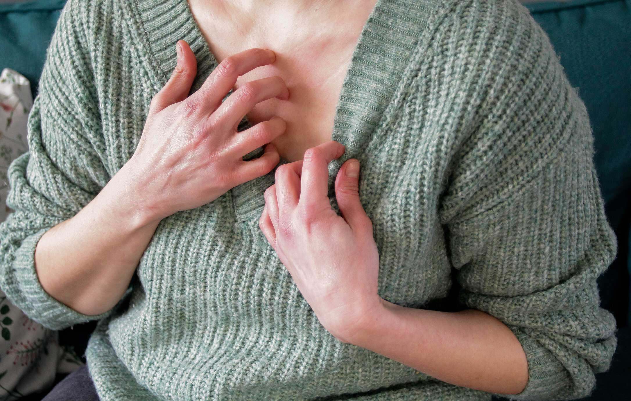 皮膚過敏5大種類｜一文了解濕疹、蕁麻疹、紅疹的症狀 醫生教你急救護理方法