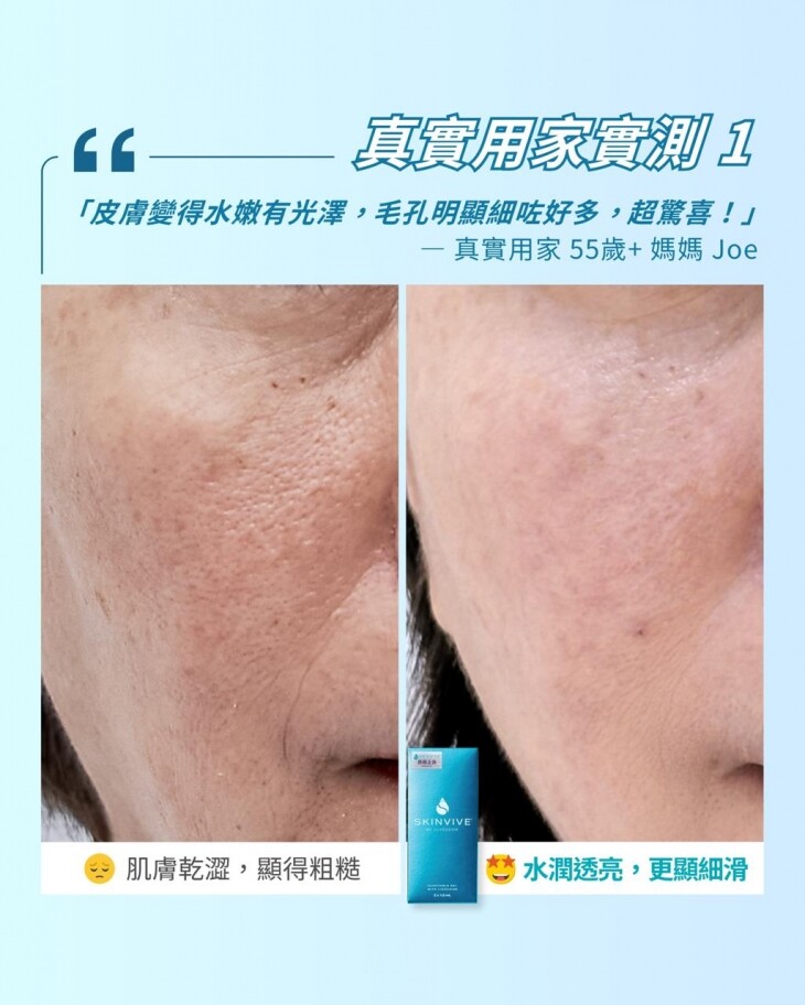 乾燥、毛孔粗大、膚色暗沉者必看！️昇光燈泡肌原來靠「它」養成~ COLLAGEN +首批引入，一步素顏細緻到爆光！