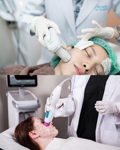Ultherapy vs Thermage醫美療程比較|一文拆解效果、適合人群、副作用、價錢及用家口碑 療程前必讀! Ultherapy vs Thermage醫美療程比較|一文拆解效果、適合人群、副作用、價錢及用家口碑 療程前必讀!