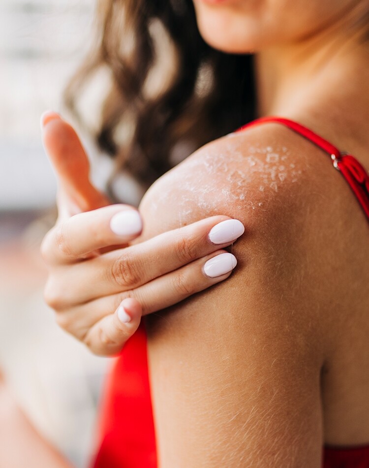 皮膚乾燥痕癢脫皮怎麼辦？