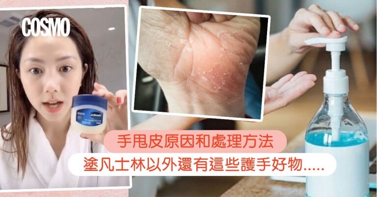 手甩皮｜手指手掌乾燥脫皮3大原因和處理方法｜塗凡士林以外還有這些選擇...