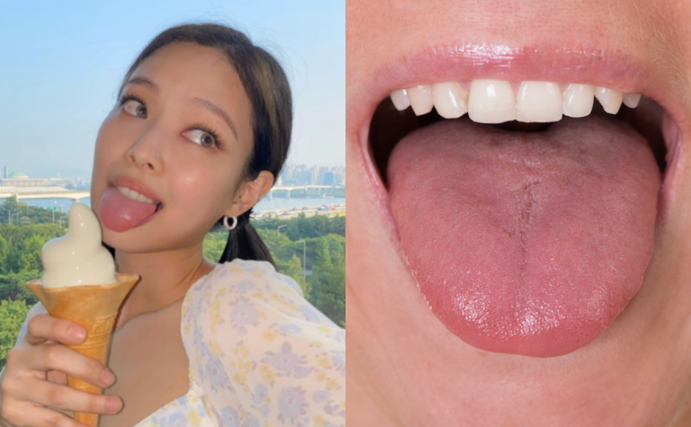舌苔變白會感冒？脷苔黃即腸胃差？4種脷苔顏色反映身體疾病