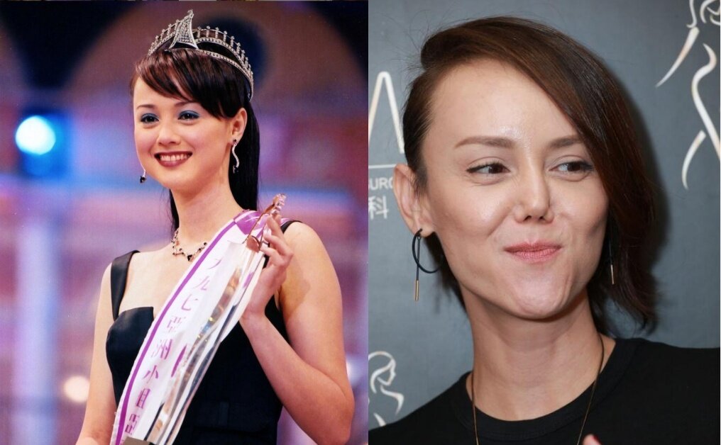 6位險破相毀容女星｜阿Sa阿嬌同傷眉骨、林心如仆崩下巴、韓君婷撼爆鼻