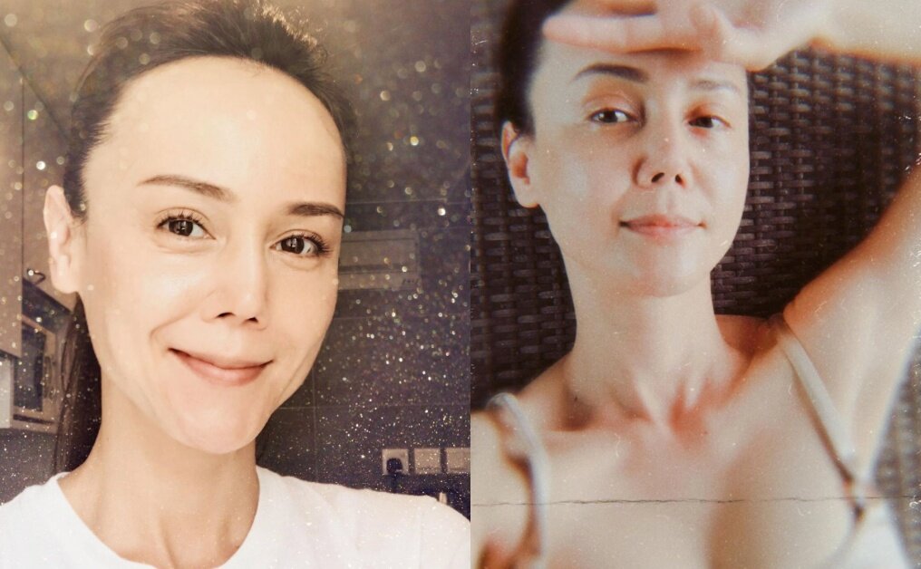 6位險破相毀容女星｜阿Sa阿嬌同傷眉骨、林心如仆崩下巴、韓君婷撼爆鼻