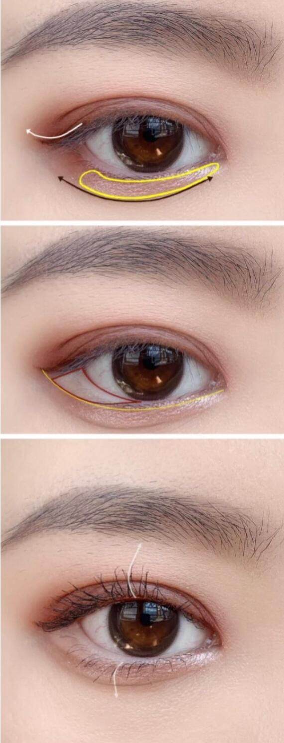 有網民留意到唐詩詠的眼睛起了巨大的變化，估計她做了開眼頭或割雙眼皮的手術。