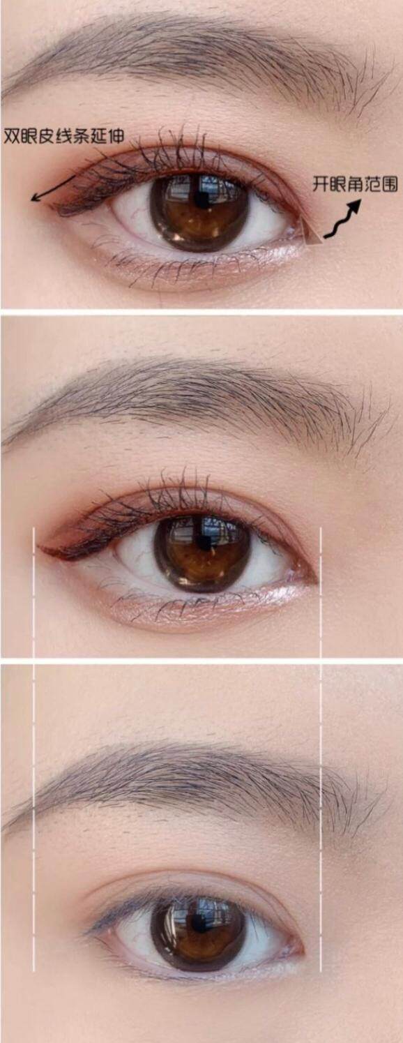 有網民留意到唐詩詠的眼睛起了巨大的變化，估計她做了開眼頭或割雙眼皮的手術。