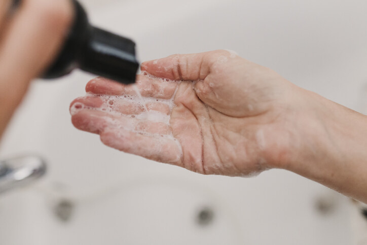 去頭皮屑方法4：留意洗頭水溫
