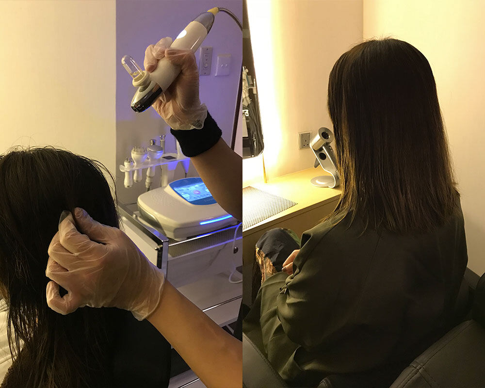 秋冬必須做的頭髮護理 2. 注養保濕髮質重塑療程配合LiftPower注氧補濕技術，以儀器將營養精華進行霧化