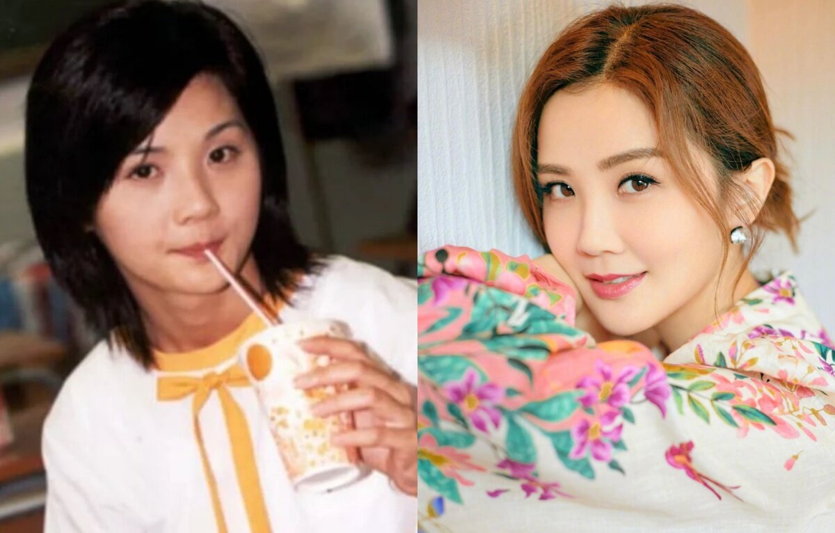 嬰兒肥甚麼時候會消失？