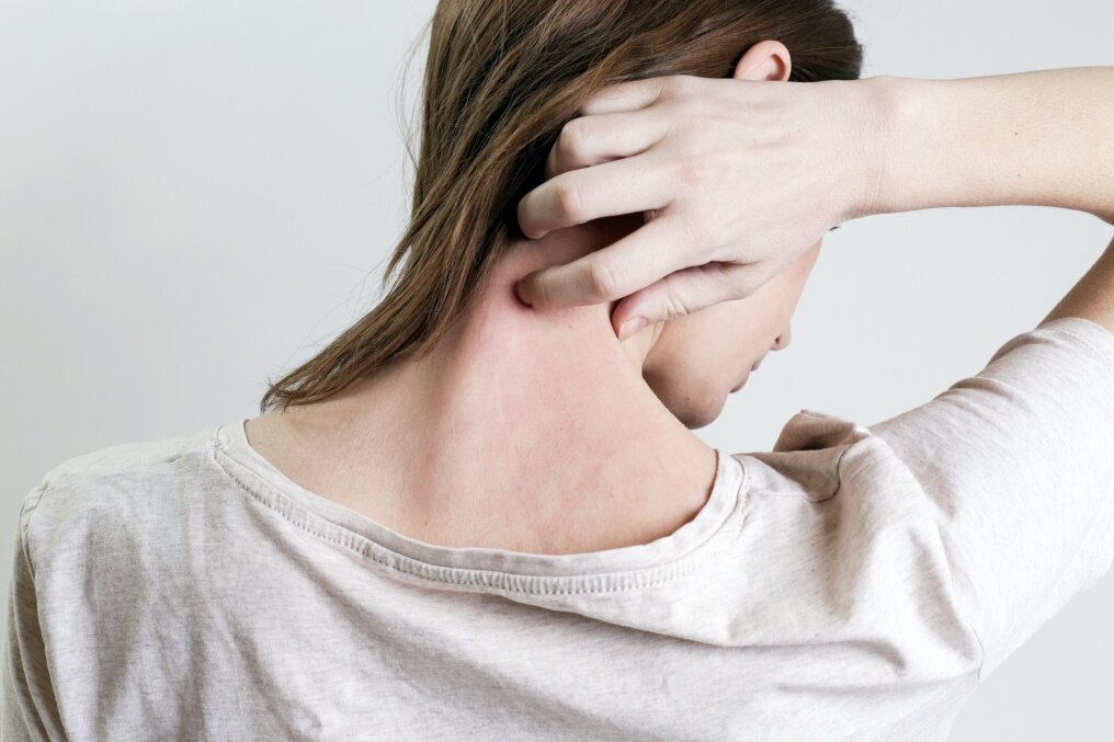 拆解皮膚痕癢原因！為甚麼晚上皮膚痕癢會特別嚴重？