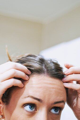 頭皮痕癢等於頭皮敏感嗎？