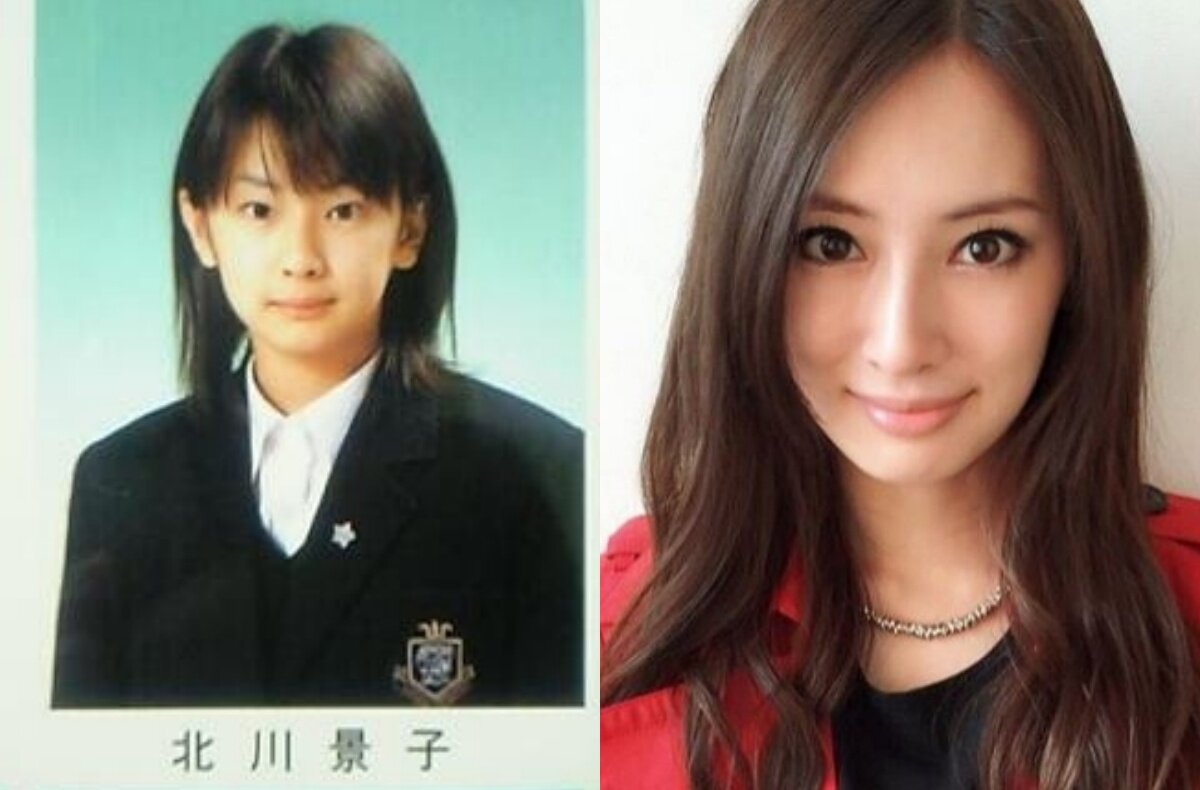 多圖】開頭骨、削下巴有村架純家姐＋日本女星整容有血有淚進化史