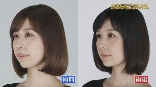 女星整容_有村藍里_有村架純