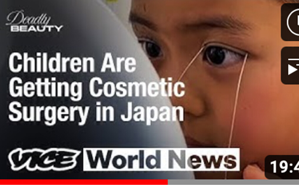日本整容年輕化？9歲女孩受媽媽勸誘割雙眼皮｜全球整容手術量日本排