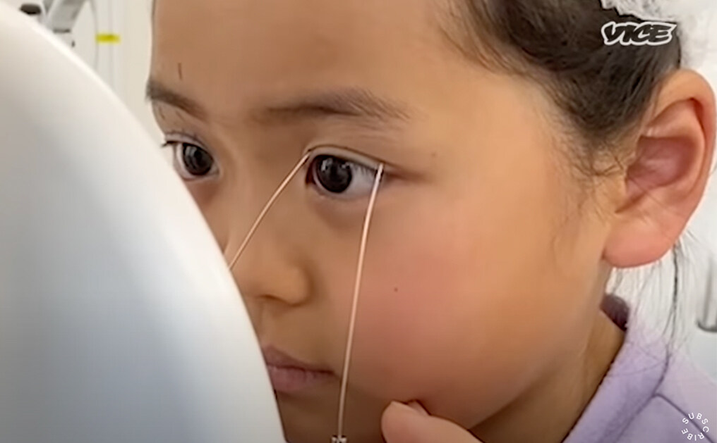 日本整容年輕化？9歲女孩受媽媽勸誘割雙眼皮｜全球美容手術量日本排