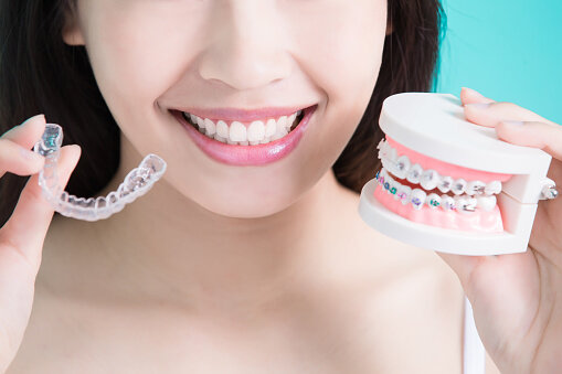 箍牙價錢比較｜4大隱形牙箍療程推薦｜Invisalign隱適美、Zenyum、Smile Direct Club、SmileLove