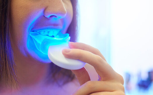 美白牙齒方法2：藍光美白牙齒