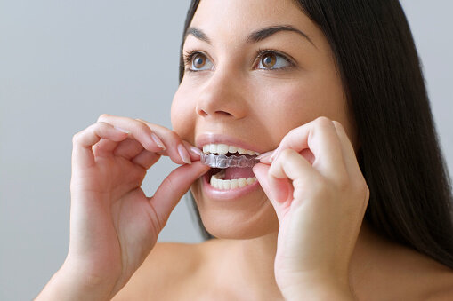 美白牙齒方法3：家用牙齒美白凝膠