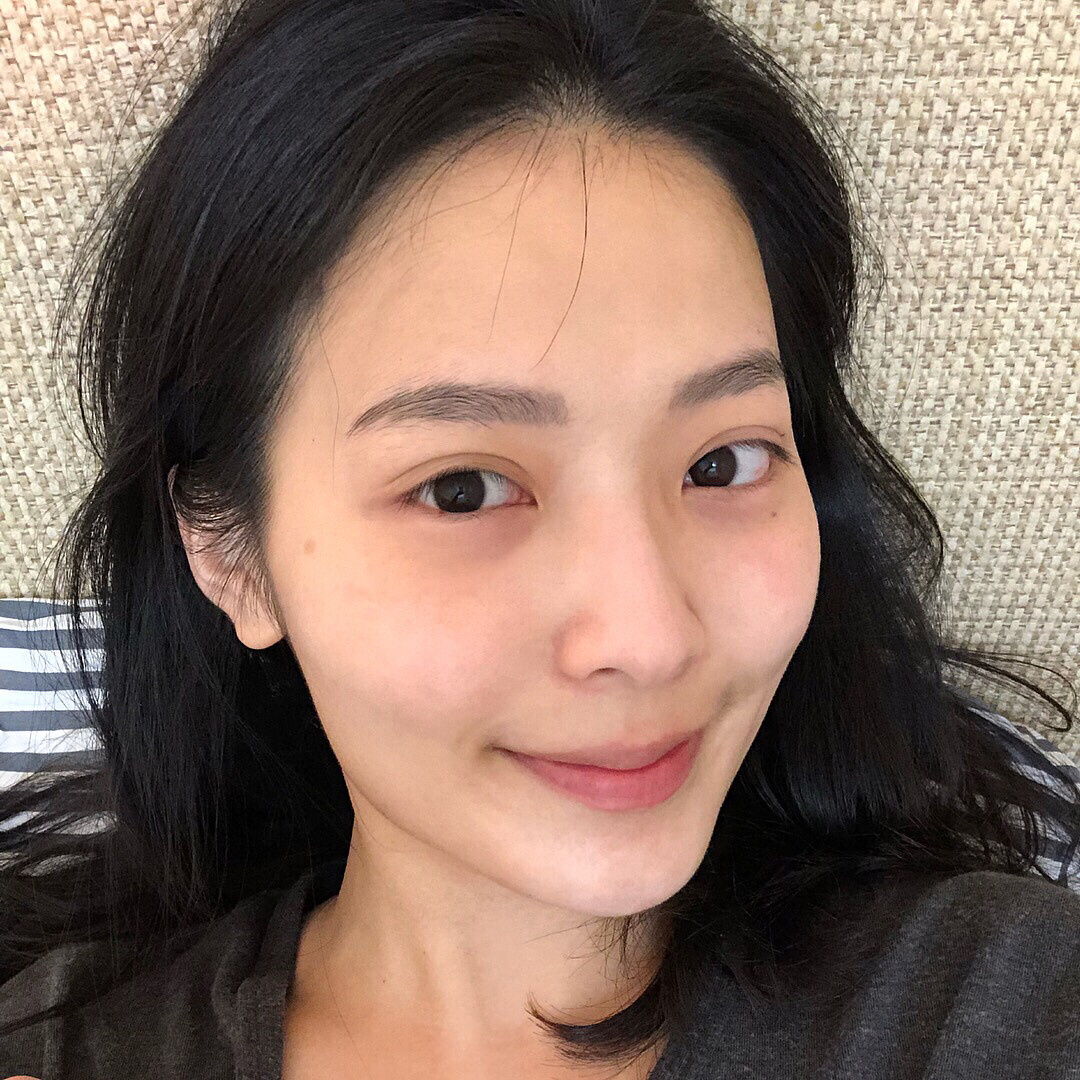 擺脫粉刺白頭的護膚貼士7: 水楊酸護膚有助去除老化角質 擺脫粉刺白頭的護膚貼士7: 水楊酸護膚有助去除老化角質