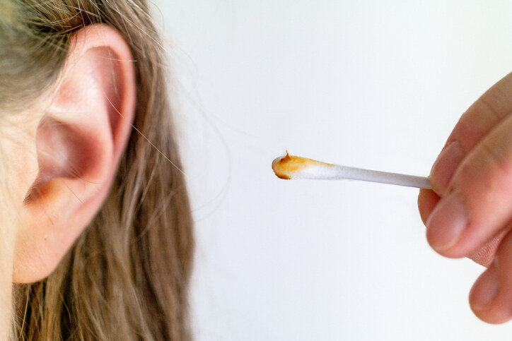 耳朵有一定的自我清潔能力，不用特別拿甚麼採耳工具去挖耳。