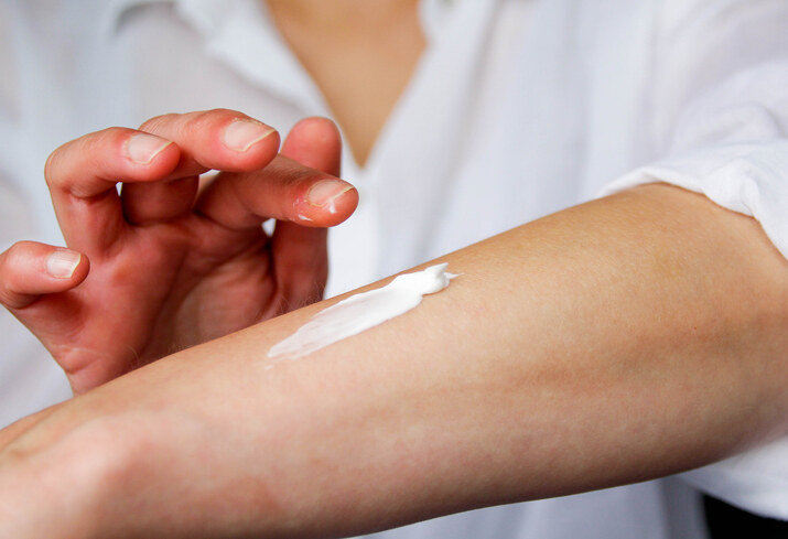 乾燥型濕疹｜皮膚科醫生解釋成因及治療方法：要對付濕疹鐵三角！