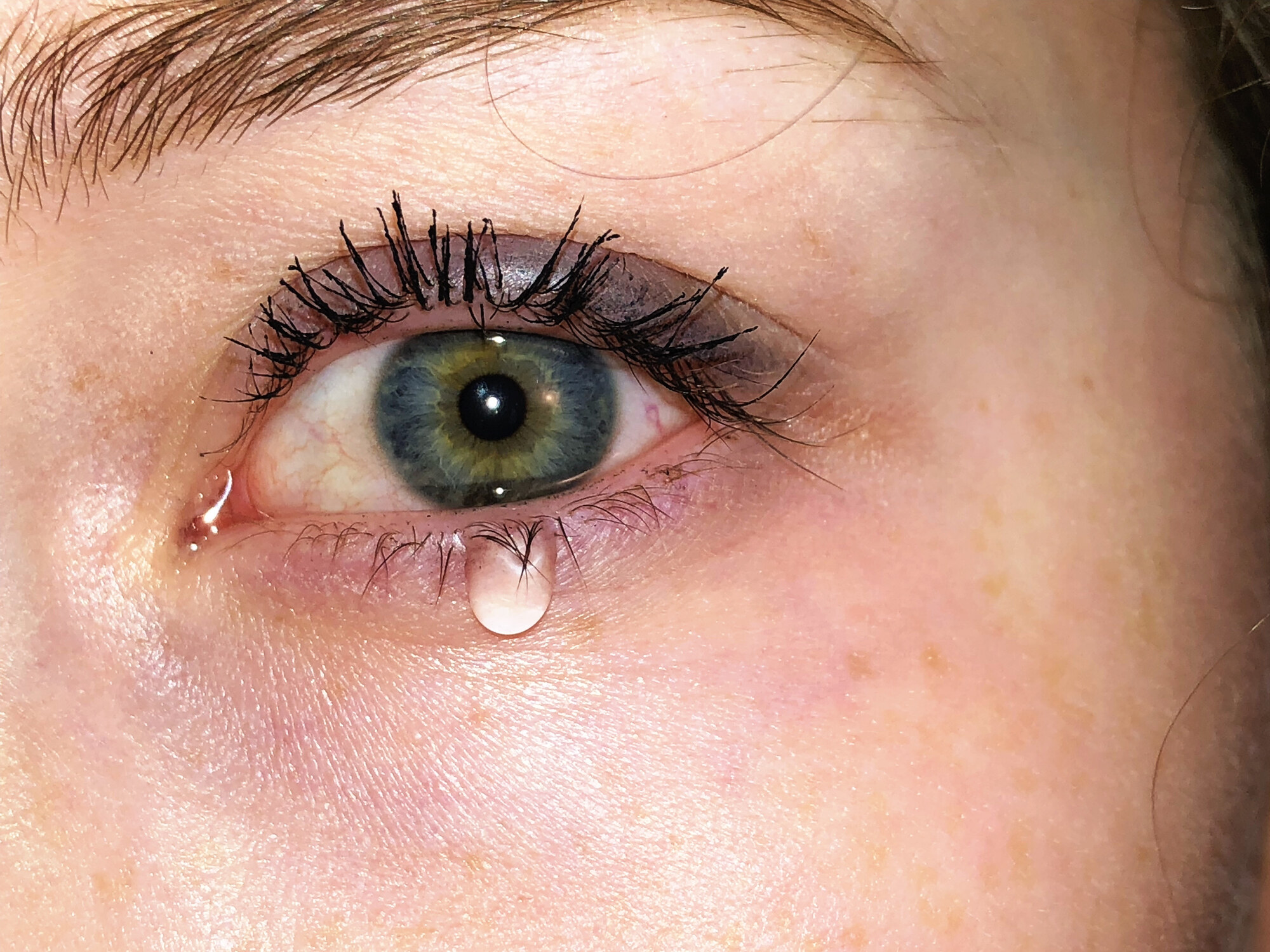 流眼水｜無故狂流眼淚原來是病！醫生解構溢淚症成因與潛藏風險：如何改