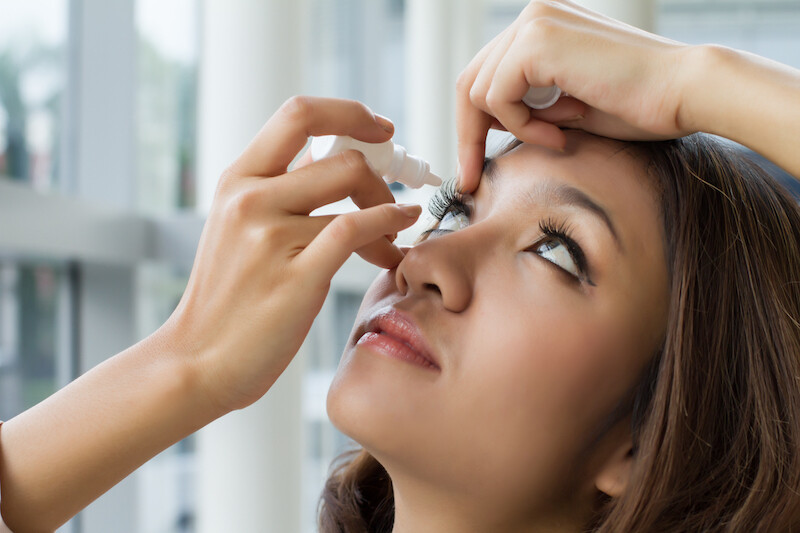 年輕女生更易眼敏感?眼科醫生拆解眼敏感成因+預防眼紅、眼痕方法! 年輕女生更易眼敏感?眼科醫生拆解眼敏感成因+預防眼紅、眼痕方法!