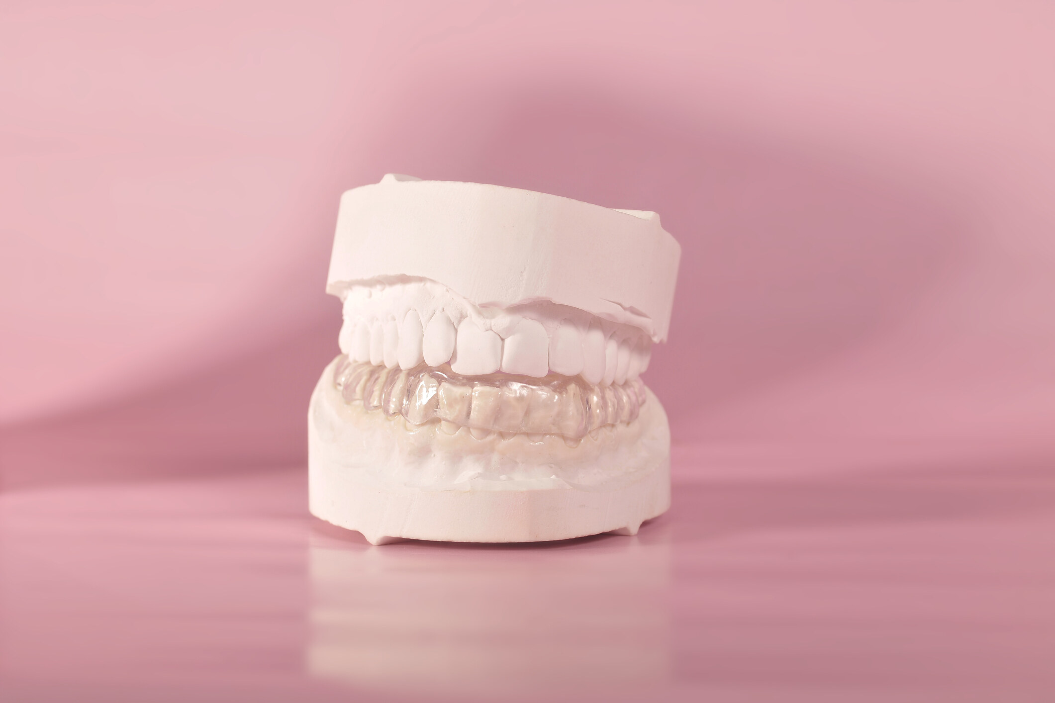 敏感牙齒｜牙醫教3招改善牙肉酸軟＋3大成因/症狀/治療方法